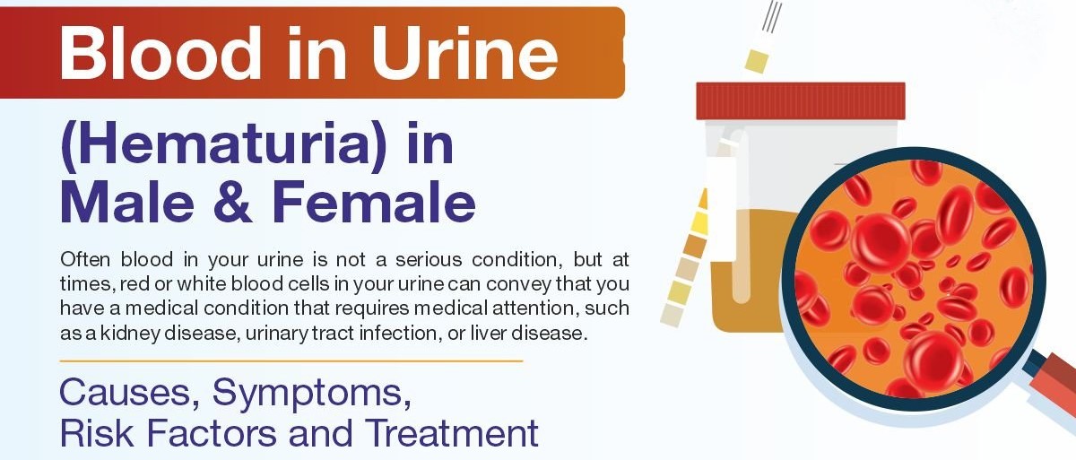 Causes, Symptoms, Prevention, Treatment Of Blood In Urine