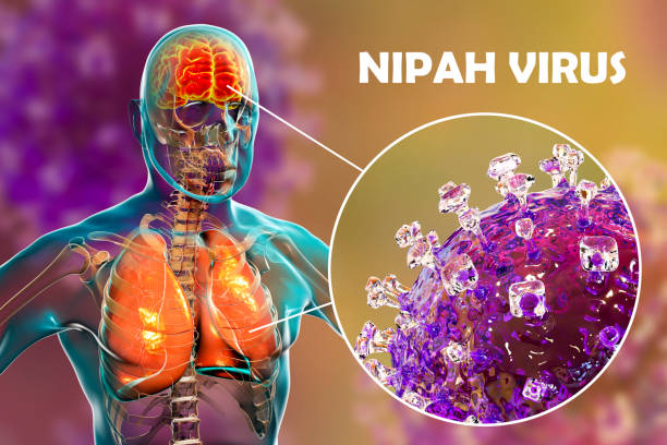 Nipah Virus Treatment